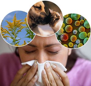 Immunology and allergology