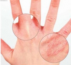 Dermatovenereology